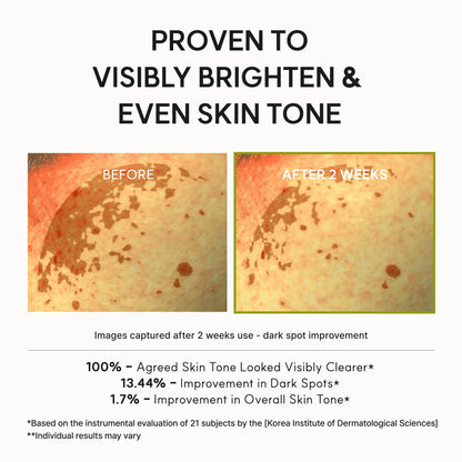 Arencia Vitamin C Booster Shot Serum with Glutathione, Niacinamide and Vitamin E for Dark Spot Care, Fine Lines & Wrinkles, Glass Skin, Korean Skincare 30ml/1.01 fl.oz